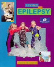 Living with epilepsy