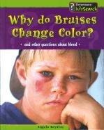Cover of: Why Do Bruises Change Color?: And Other Questions About Blood (Body Matters)