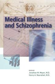 Medical illness and schizophrenia