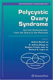 Polycystic ovary syndrome by Andrea Dunaif