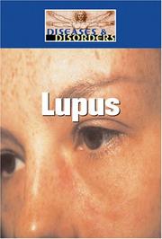 Cover of: Lupus (Diseases and Disorders) by Melissa Abramovitz
