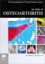 An atlas of osteoarthritis