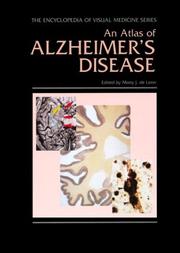 An atlas of Alzheimer's disease