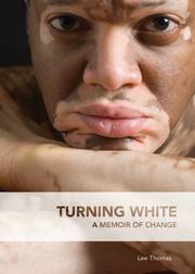 Cover of: Turning White: A Memoir of Change