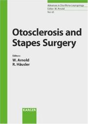 Otosclerosis and stapes surgery