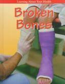 Cover of: Broken bones by Kenneth T. Burles