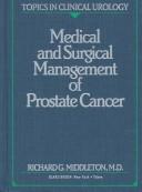 Medical and surgical management of prostate cancer