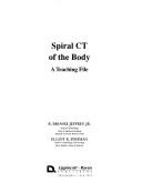 Cover of: Spiral CT of the body: a teaching file