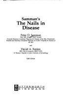 Samman's the nails in disease