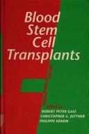 Blood stem cell transplants