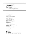 Diseases of the liver and biliary tract