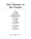 Oral diseases in the tropics