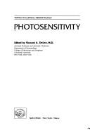 Photosensitivity