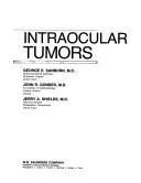 Intraocular tumors