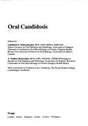 Oral candidosis