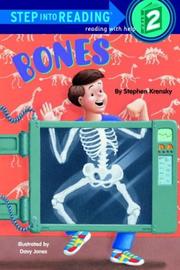 Cover of: Bones by Stephen Krensky