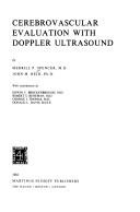 Cover of: Cerebrovascular evaluation with Doppler ultrasound