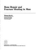 Bone repair and fracture healing in man