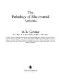 The pathology of rheumatoid arthritis