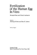 Cover of: Fertilization of the Human Egg in Vitro: Biological Basis and Clinical Application