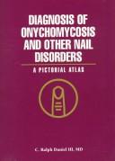 Cover of: Diagnosis of onychomycosis and other nail disorders: a pictorial atlas