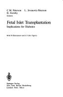 Cover of: Fetal islet transplantation: implications for diabetes