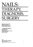 Cover of: Nails: therapy, diagnosis, surgery