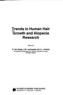 Trends in human hair growth and alopecia research