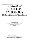 A colour atlas of sputum cytology by Gordon Canti