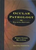 Ocular pathology