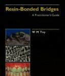 Resin-bonded bridges