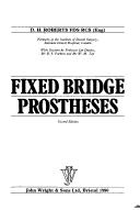 Fixed bridge prostheses