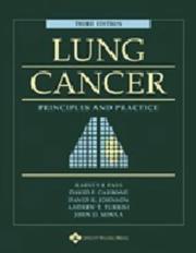 Lung cancer : principles and practice