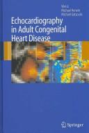 Echocardiography in adult congenital heart disease