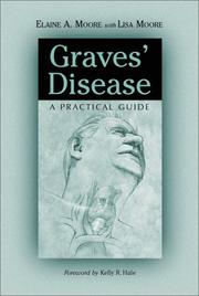 Cover of: Graves' Disease: A Practical Guide