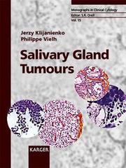 Salivary gland tumours