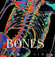 Cover of: Bones: our skeletal system