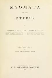 Cover of: Myomata of the uterus