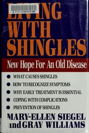 Cover of: Living with shingles: new hope for an old disease