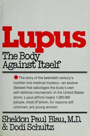 Cover of: Lupus, the body against itself