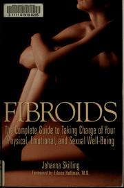 Cover of: Fibroids by Johanna Skilling