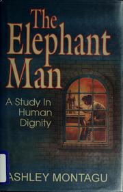 Cover of: The elephant man: a study in human dignity