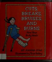 Cover of: Cuts, breaks, bruises, and burns: how your body heals