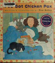 Cover of: I've got chicken pox