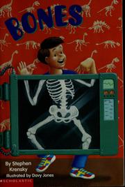 Cover of: Bones by Stephen Krensky