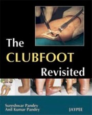 Cover of: The Club Foot Revisited