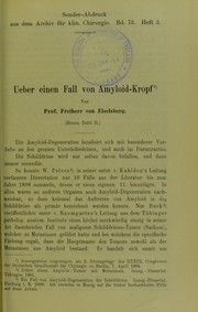 Cover of: Ueber einen Fall von Amyloid-Kropf