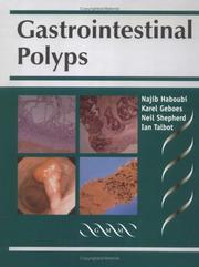 Gastrointestinal polyps