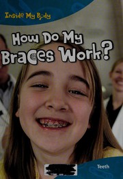 How do my braces work? by Steve Parker