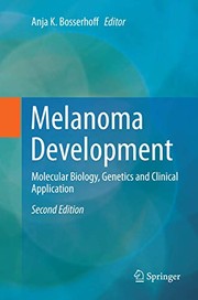 Cover of: Melanoma Development